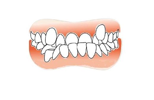 老人吃东西咬嘴唇怎么回事,老人吃东西经常咬舌头怎么回事