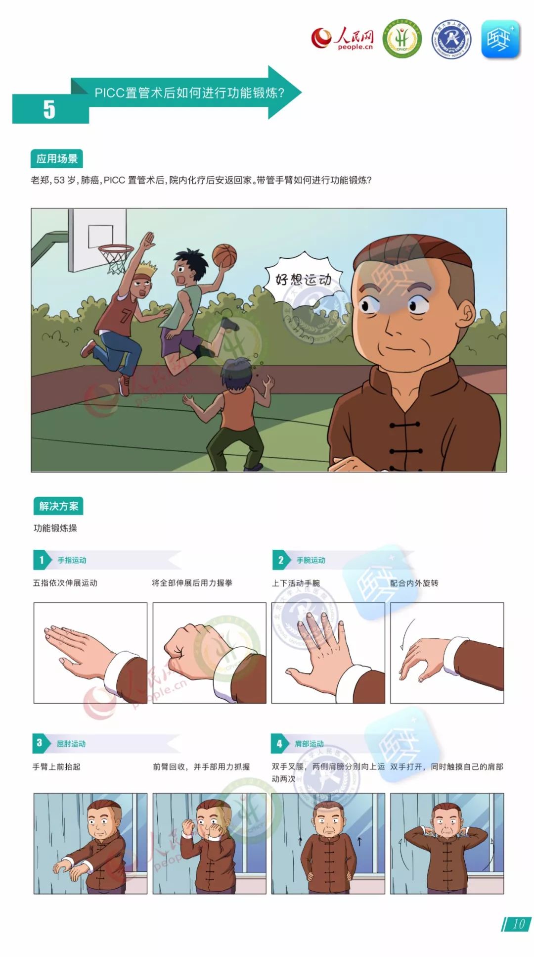 picc置管术后,picc术后功能锻炼流程