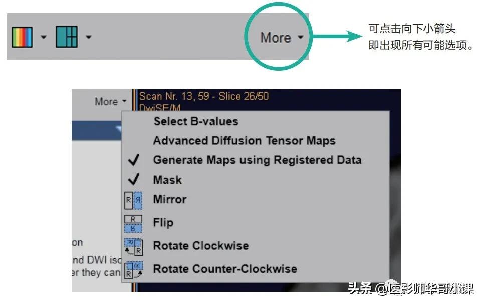 飞利浦磁共振波谱成像扫描技术,飞利浦磁共振纵隔扫描技术