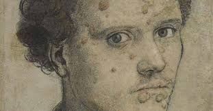 水蛭吸血可治病？结果几百年前的西方人因此导致梅毒的交叉感染