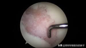 为什么春季膝关节比平时疼得厉害,膝关节凉嗖嗖的疼是什么病