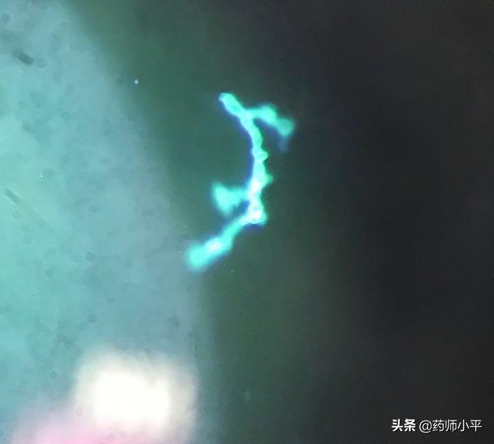 美国真菌感染死亡人数,美国超级真菌感染的症状