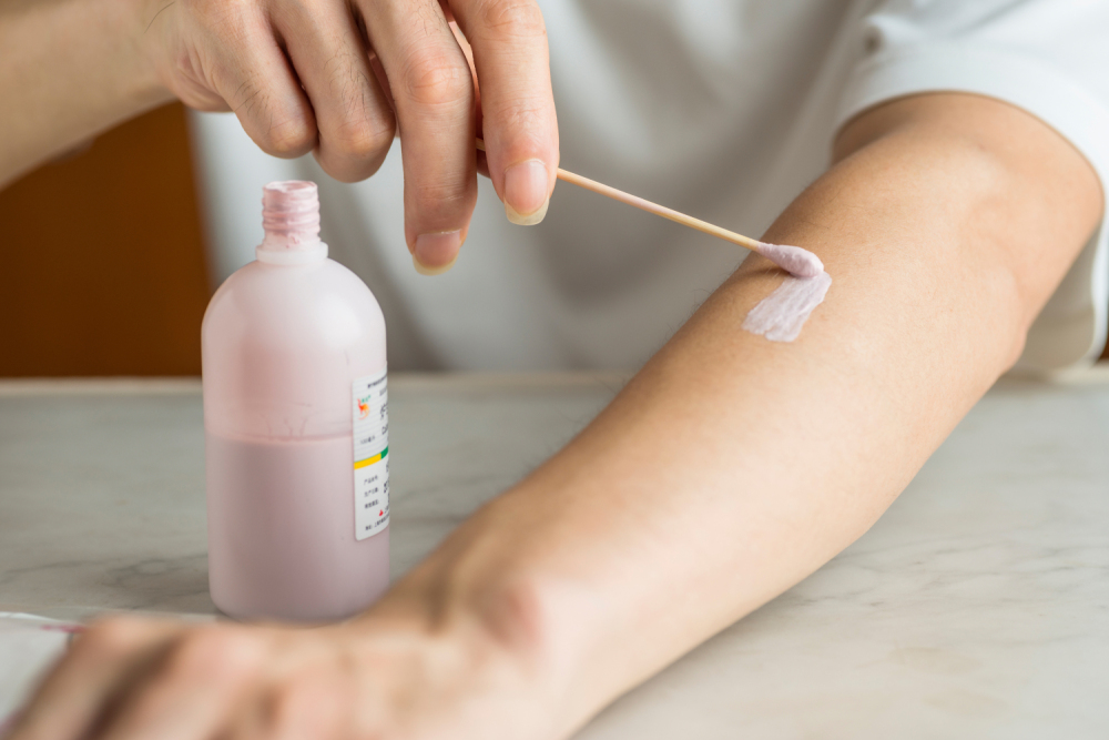 夏天睡凉席有红点,夏季凉席易诱发皮炎