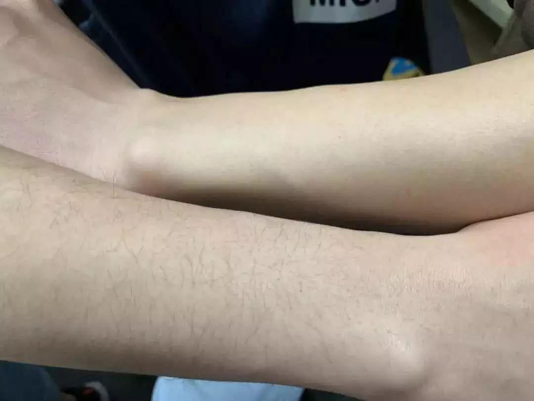 美白脱毛永久有效的产品,大家有什么好的永久脱毛推荐