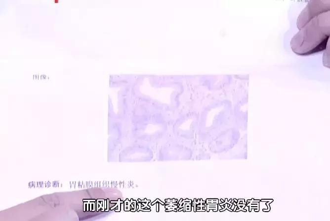 90岁女中医针灸,86岁女国医养生视频