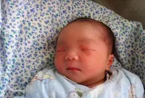 新生儿皮肤问题怎么解决,家有新生儿怎么办