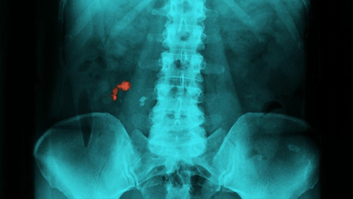 小村流传孤坟神土治病,神医包医百病