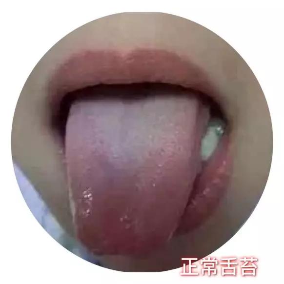 儿童感冒发烧的症状和处理方法,目前小儿感冒发烧有哪些现象