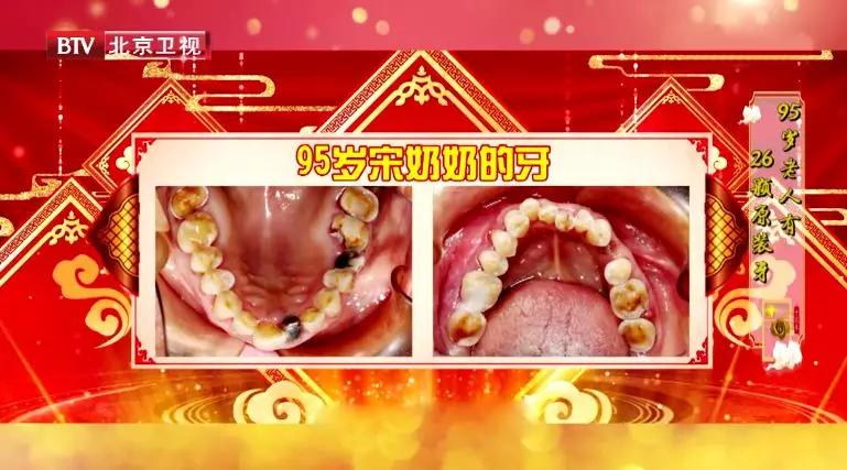 吃饭老塞牙缝怎么治疗,吃饭总塞牙你知道问题出在哪里吗