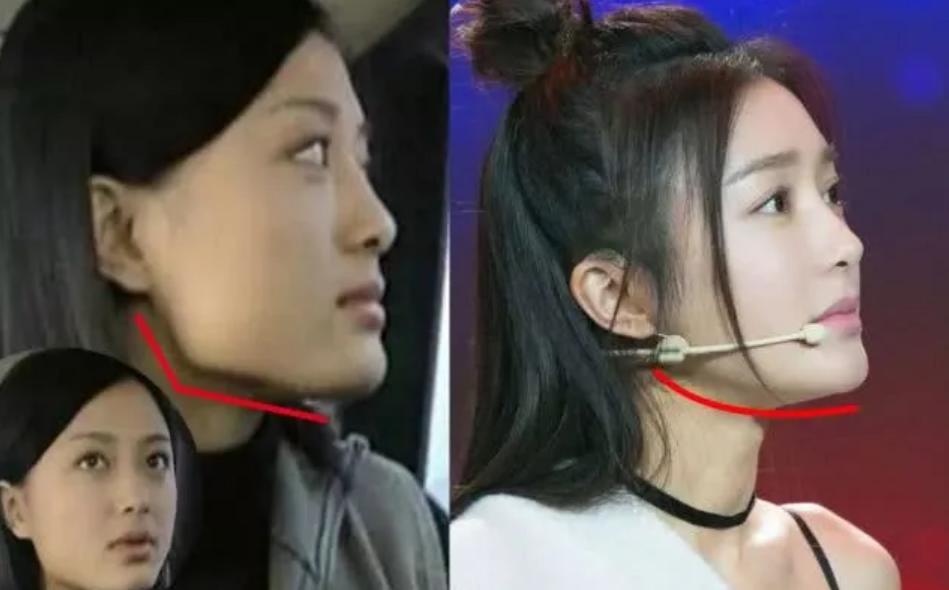 如何判断你是不是下巴短,怎么看你是圆下巴还是尖下巴