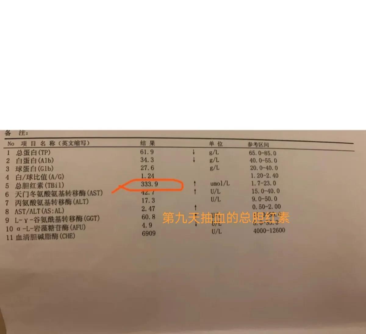 宝宝黄疸好转有哪些征兆,亲身经历宝宝黄疸过程