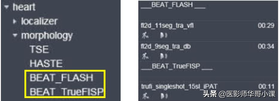 磁共振心脏扫描标准切面,心脏mri扫描定位