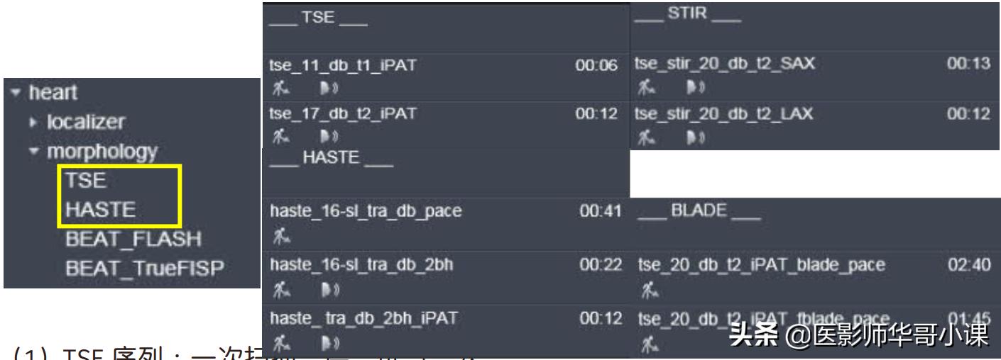 心脏mr增强扫描讲解,磁共振心脏扫描标准切面