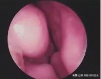 为啥来院就做内镜检查?医生怕是在骗我钱吧