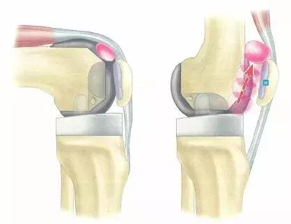 鎬庝箞鏍蜂笉璺戞杩樺彲浠ユ湁璺戞璁板綍,鍙互璺戞涔熷彲浠ヤ笉璺戞