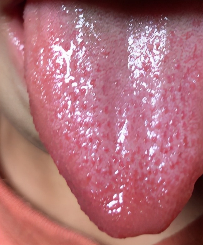 九大体质辨识与调理方法表,体质辨识技巧有哪些方法