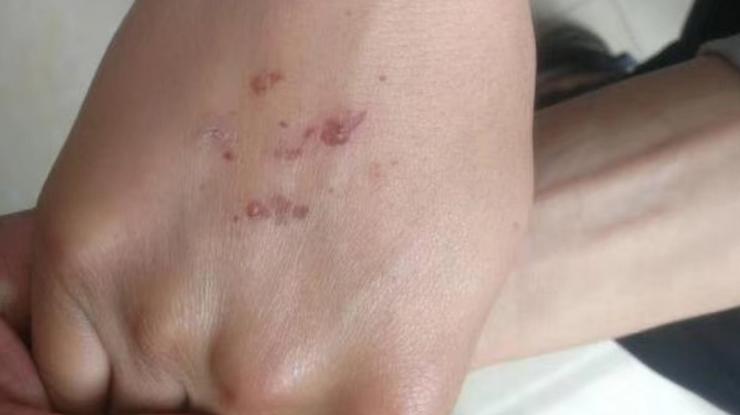 职校生被同学霸凌后续,职校生遭同学霸凌