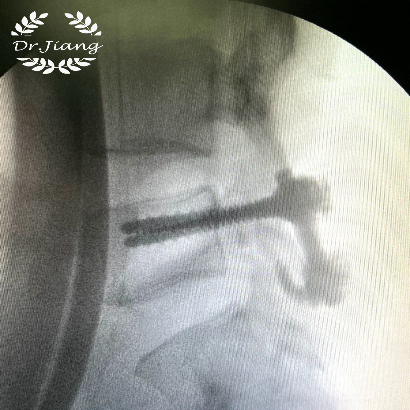 青少年脊柱弯曲危害科普视频,脊柱病科普小常识大全