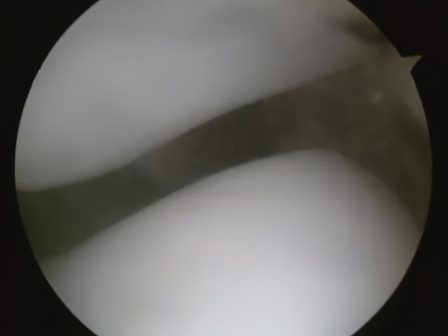 骨科医生教你一招搞定膝盖痛,不同部位膝关节