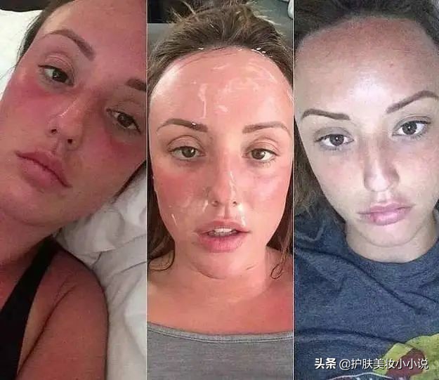 ​芦荟胶五大实用功能大公开，平价且多用，难怪是宝藏型护肤品！