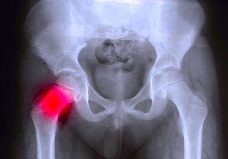 双血统的拉布拉多会有遗传病吗,拉布拉多得了遗传病怎么治疗