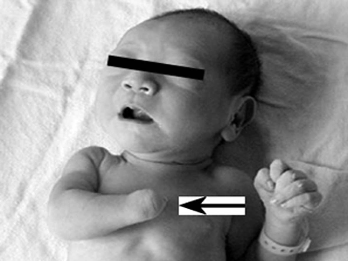 羊水彩超和普通彩超哪个更准,羊水异常的超声诊断