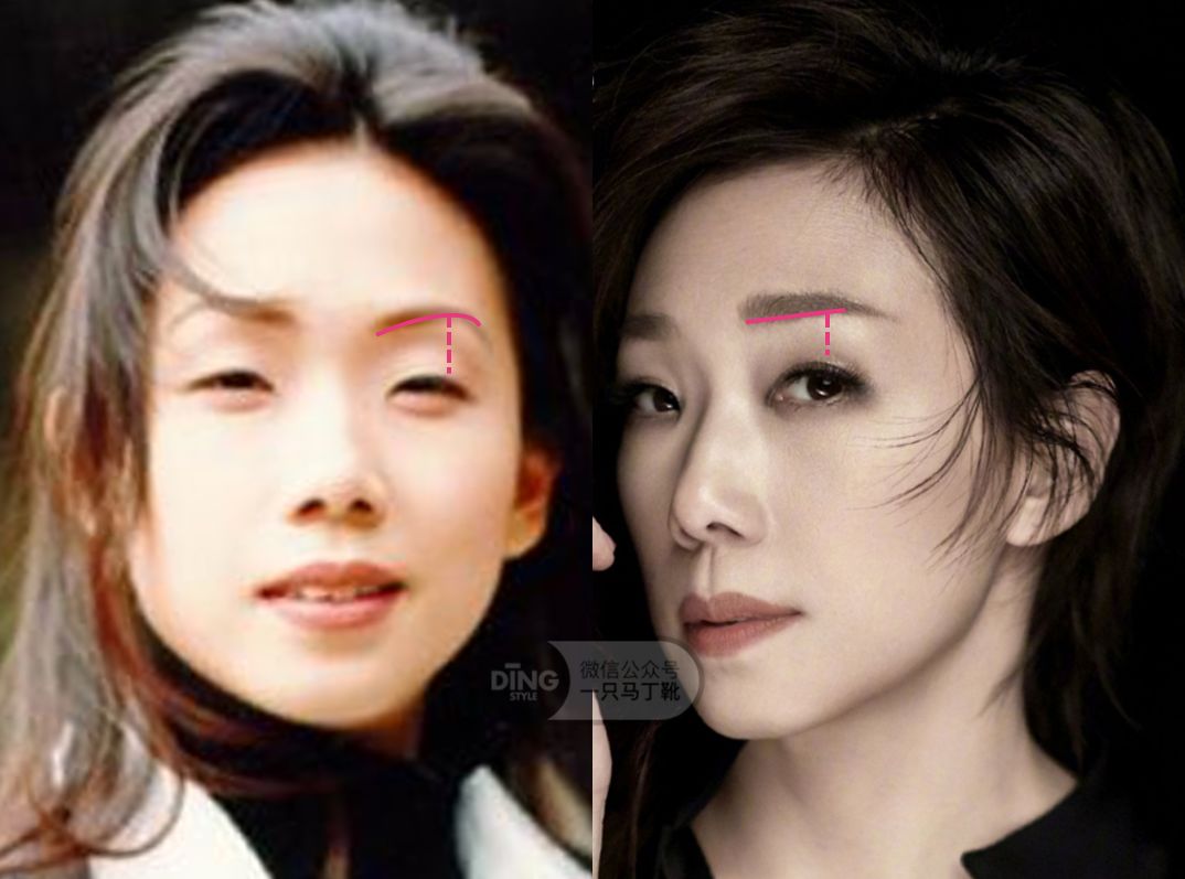 为什么眼神呆滞无神怎么训练,表情僵硬眼睛无神