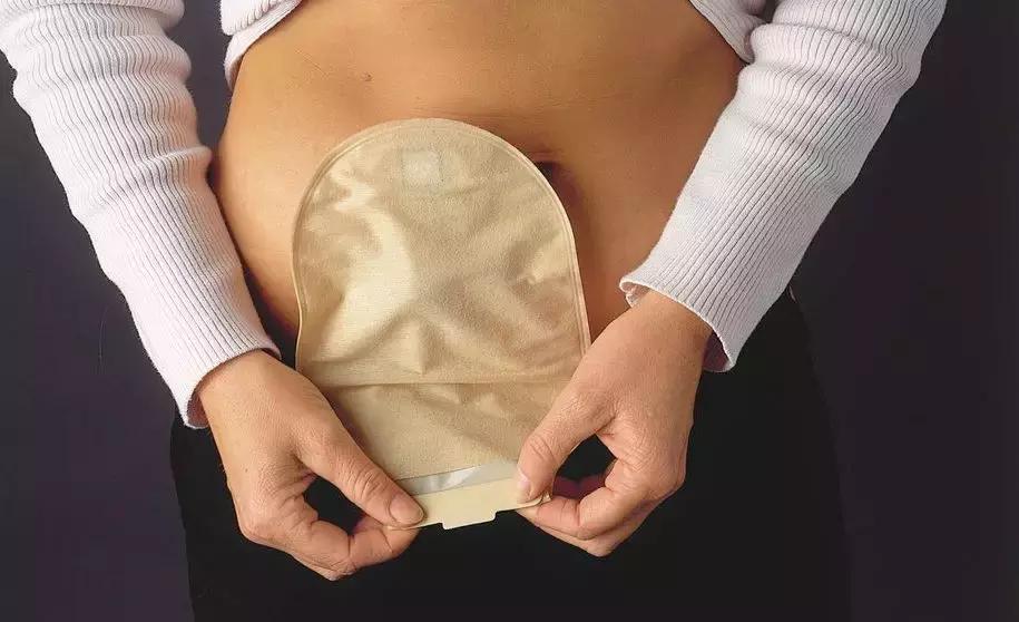 我只是偶尔大便带血，以为只是痔疮，怎么就成了肠癌呢？