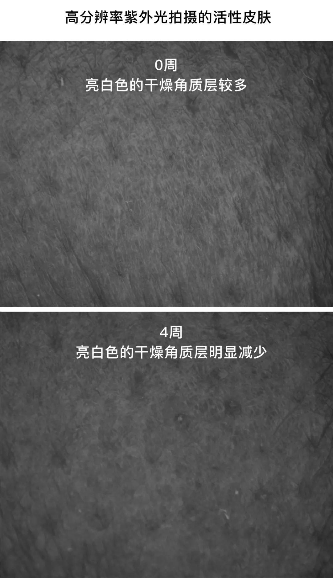 sk-II神仙水真的好用吗,SK-II神仙水好用吗