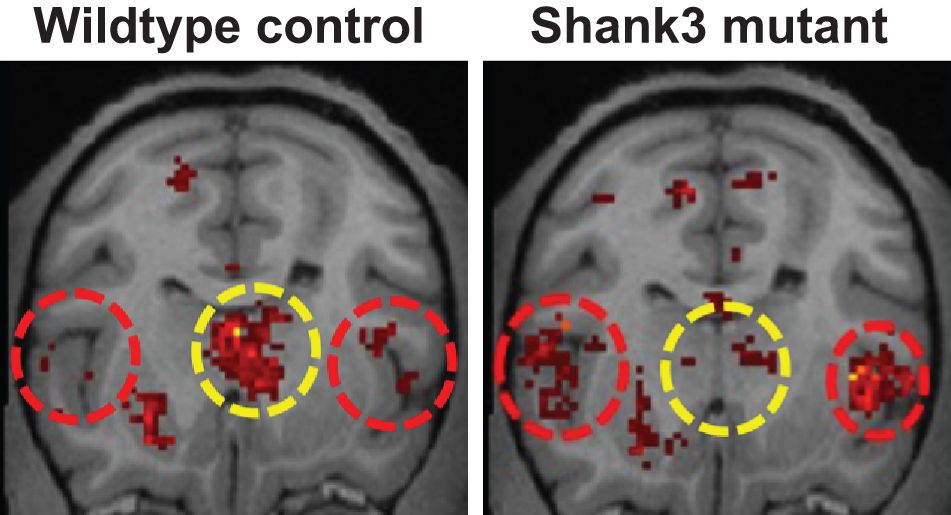中美nature发表论文对比,美国自闭症科学研究进展