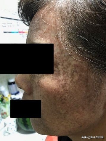 太惨了!这起染发*案惨**在韩国又双叒发生了