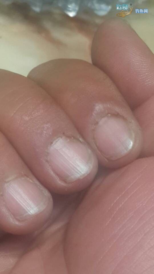 从泛滥的化工钓鱼小药，到马蜂蛰、蜂毒和神经毒素