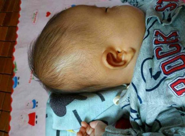 宝宝后脑勺老是往后顶,宝宝老是头偏一边婆婆老说烦死了