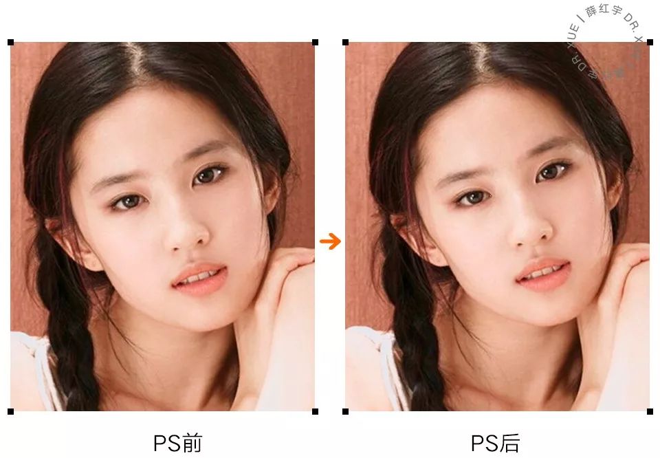 从美术角度谈眯眯眼,开内眼角传统术式