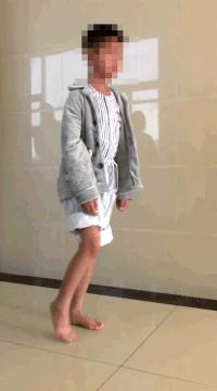 踮脚走路能改善足内翻吗,经常踮脚会伤膝关节吗