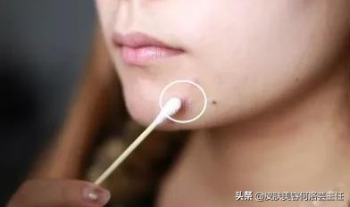 疮疡病的症状及治疗方法,生疮的症状和治疗方法