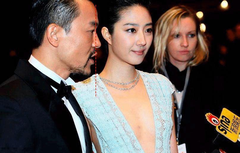 面中部凹陷下巴微翘,朱元璋式下巴怎么矫正