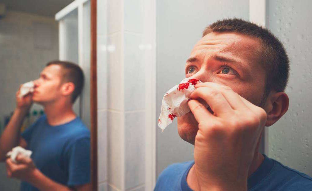 打球撞到鼻梁流血,打球撞到鼻子该怎么办