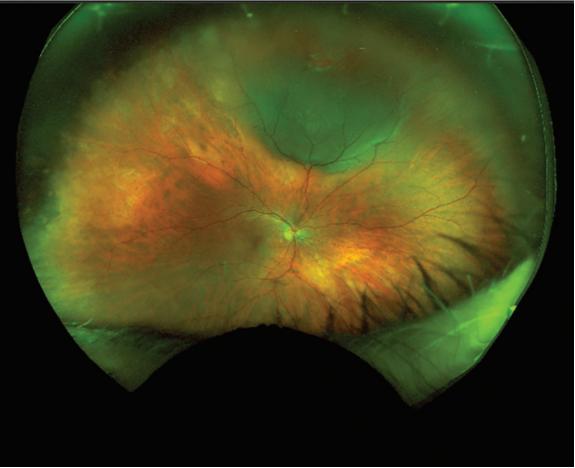对眼药水过敏怎么办,对眼药水过敏怎么解决