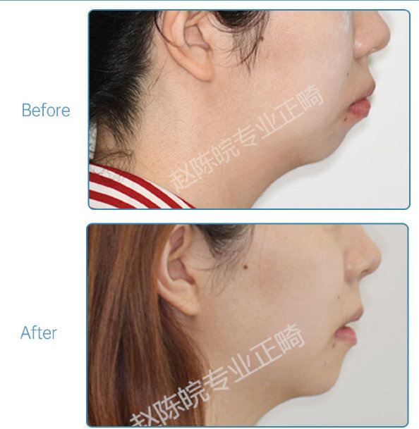 杭州口腔医院整牙,杭州整牙医生怎么选