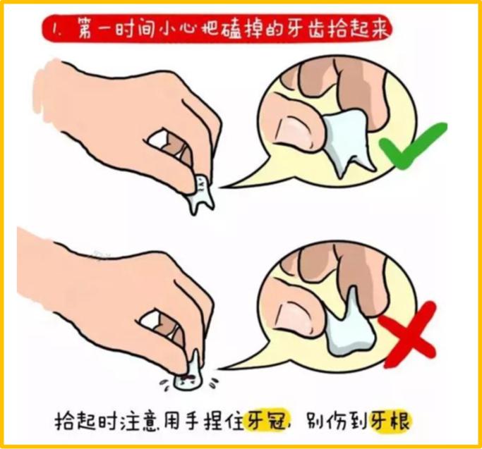 牙齿断了把牙根拔出,牙齿断了拿另一半能补吗