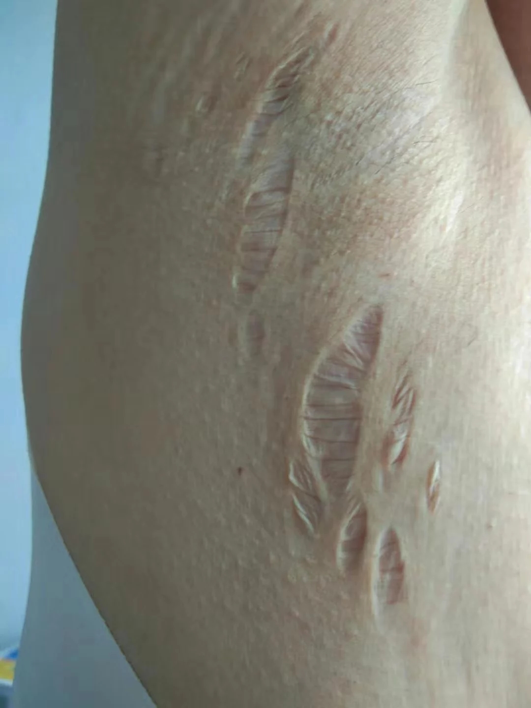 脊背发凉！女医生发文称遭前夫婚内投毒：这是一场有预谋的蓄意谋杀