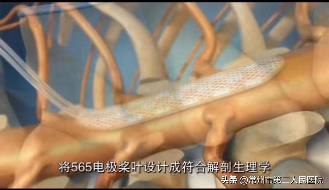 常州市二院疼痛科,常州二院疼痛科