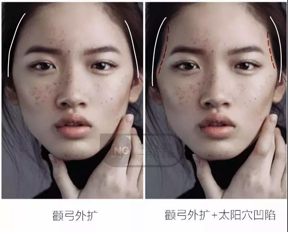 颧骨为什么不能美成俞飞鸿,俞飞鸿颧骨抗老