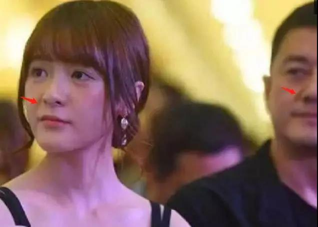 法令纹显老10岁三种方法帮助改善,最显老的法令纹怎么改善