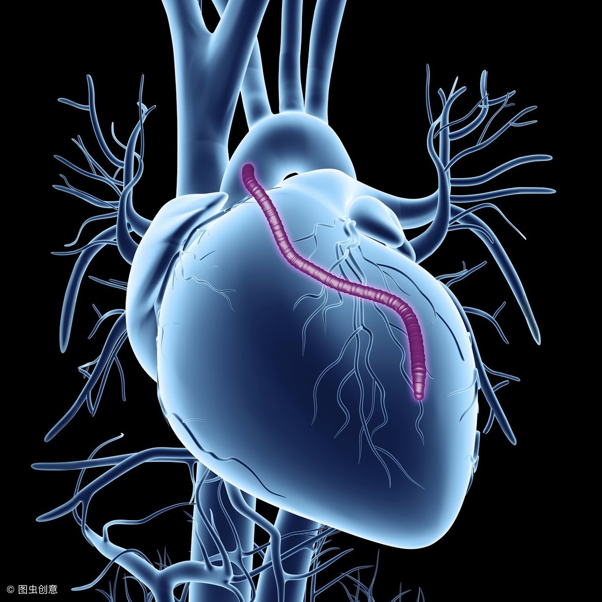 冠脉ct能看到血管粥样硬化,做冠脉ct能看出来心肌缺血吗