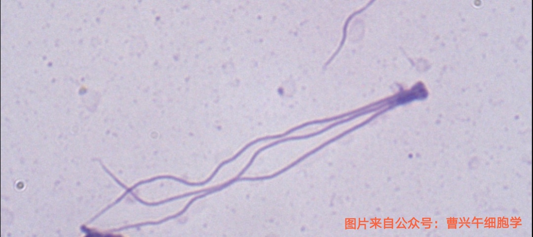 男科诊疗纪实,男科专家谈精子系列