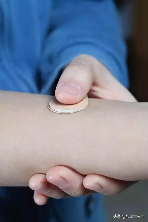 女性避孕贴片新型,美国避孕贴效果怎么样