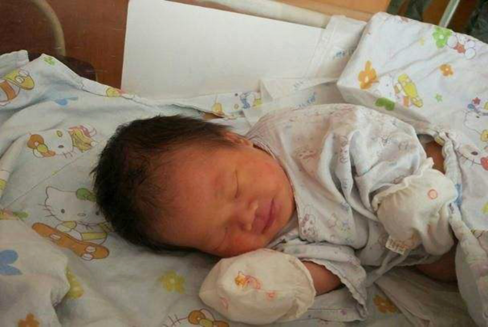 宝宝头上斑秃是什么原因造成的,是不是每个宝宝都秃顶