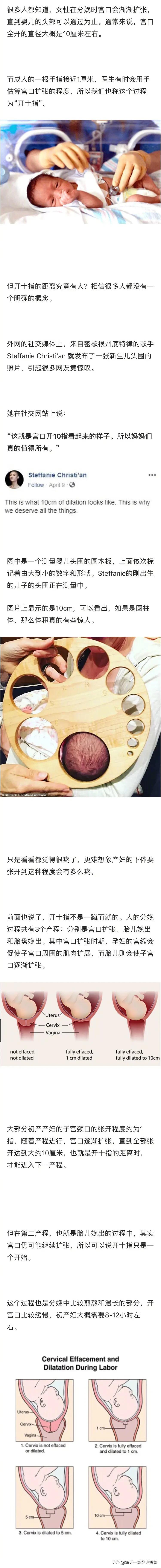 女人生孩子开几指才能顺产,女人生娃开宫口开几指快生了